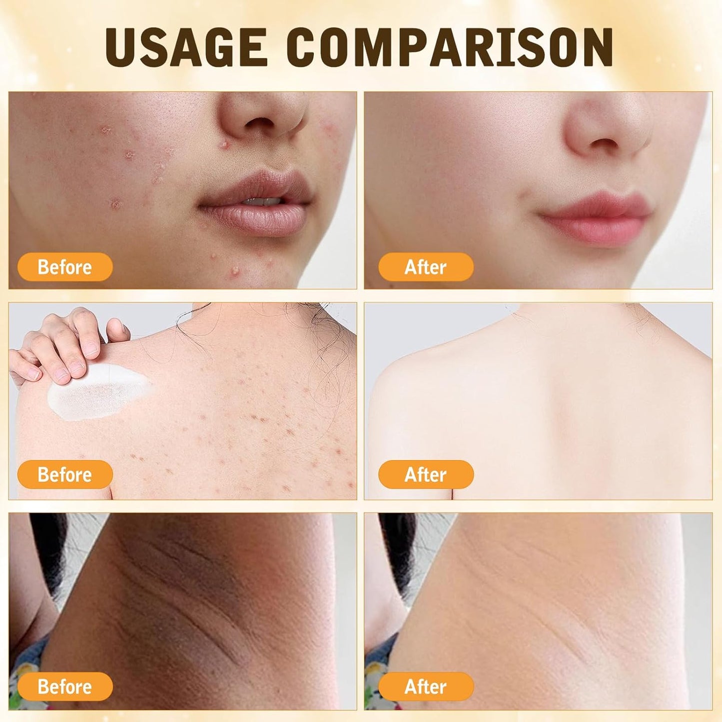 Bee Venom Comprehensive Cream,Bee Venom Skin Treatment Cream,Advanced Firming & Wrinkle-Reducing cream Natural Skin Moisturizer for All Skin Types(2PCS)