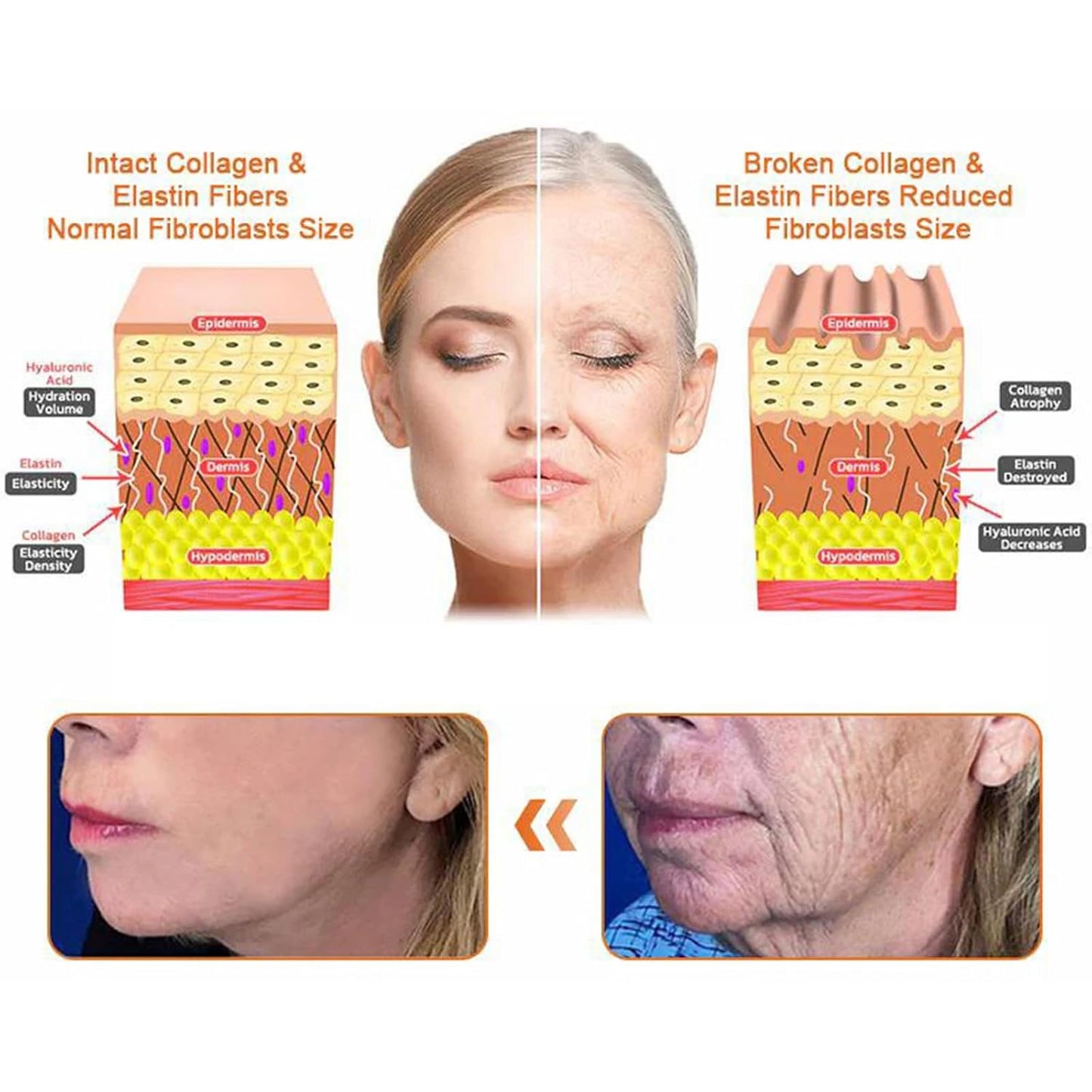 Bee Venom Comprehensive Cream, Professional bee venom cream for Removing and Repair, APKAPK Bee Venom Skin Treatment Cream, Natural Serum Suitable for All Skin Types (4 Pack)