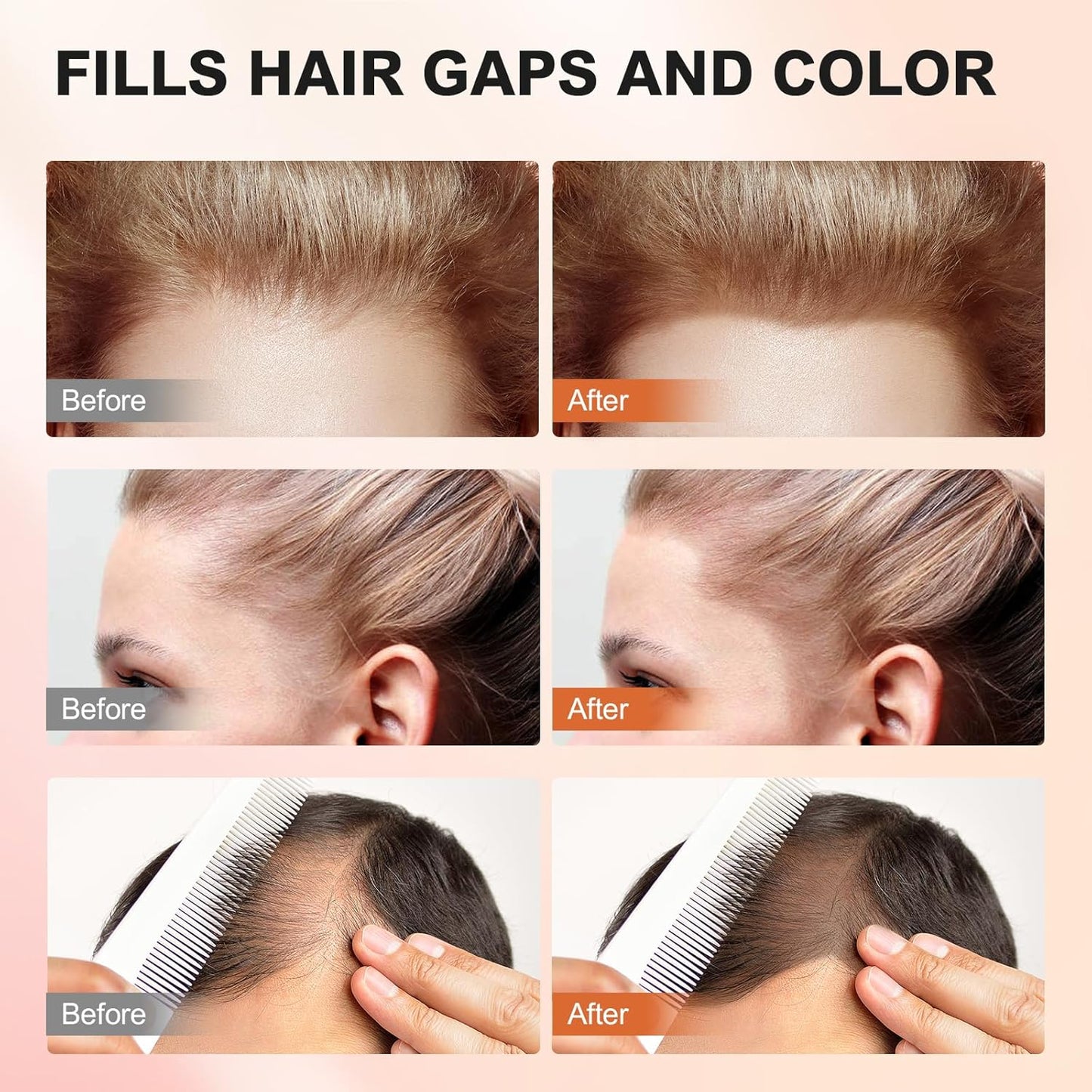 Root Touch Up Powder, Hairline Shadow Concealer for Women's Eyebrows and Men's Beard Lines, Covers Bald Spots (Medium Brown)