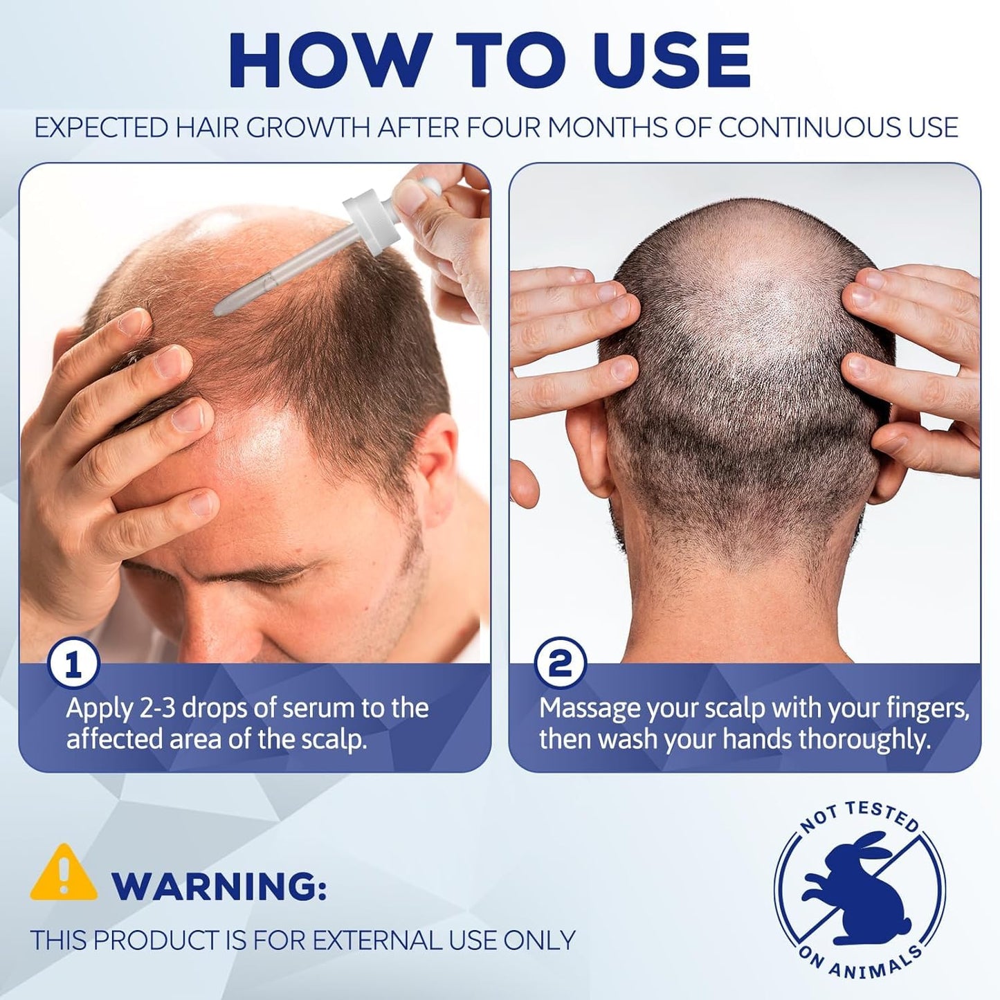 5% Minoxidil for Men and Women, Hair Regrowth Treatment for Thinning Hair and Hair Loss, Topical Solution - 2 Months Supply - Dermatologist recommended (Pack of 2)