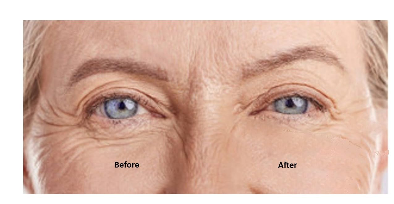 Miracle Instant Eye Lift Eye Cream Anti-Wrinkle