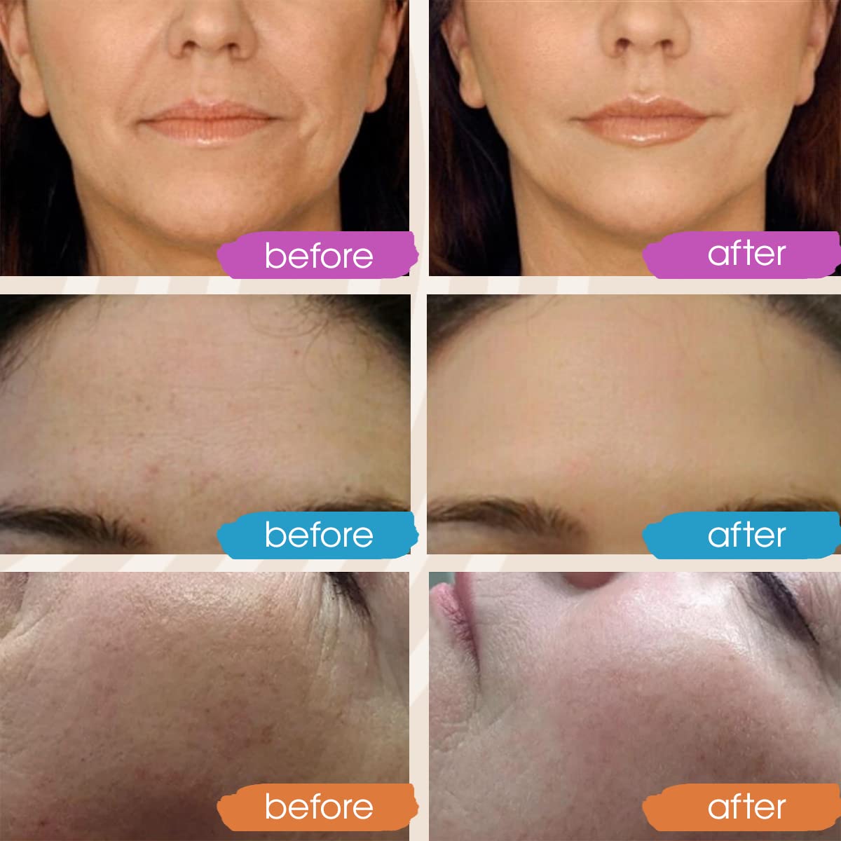 Vitamin C Face Serum, Hydrating Vitamin C Serum for Face with Hyaluronic Acid, Suitable For All Skin Types, Targets the Appearance of Dull Spots 2oz