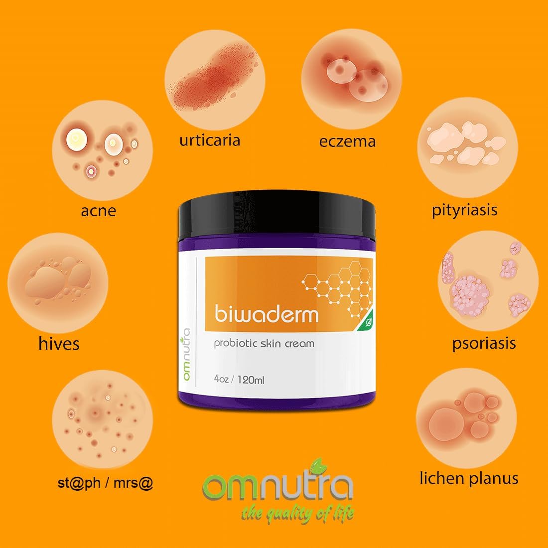 Biwaderm Probiotic Skin Cream - 4OZ Organic Based Topical Probiotics for Skin Care Eczema Treatment Psoriasis Treatment for Folliculitis Treatment Pure Aloe Vera Gel 4oz