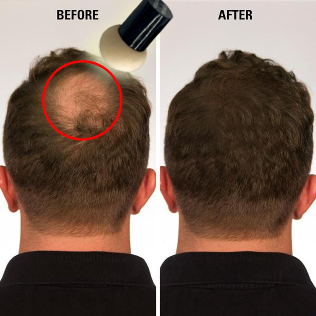 KERATIN RESEARCH Hairline Filler Unisex Mineral Powder Root Touch-Up Hair loss Concealer Scalp & Beard Bald Patch Coverage Fibers for Thinning Hair Waterproof Organic Natural look (BLACK, XL)