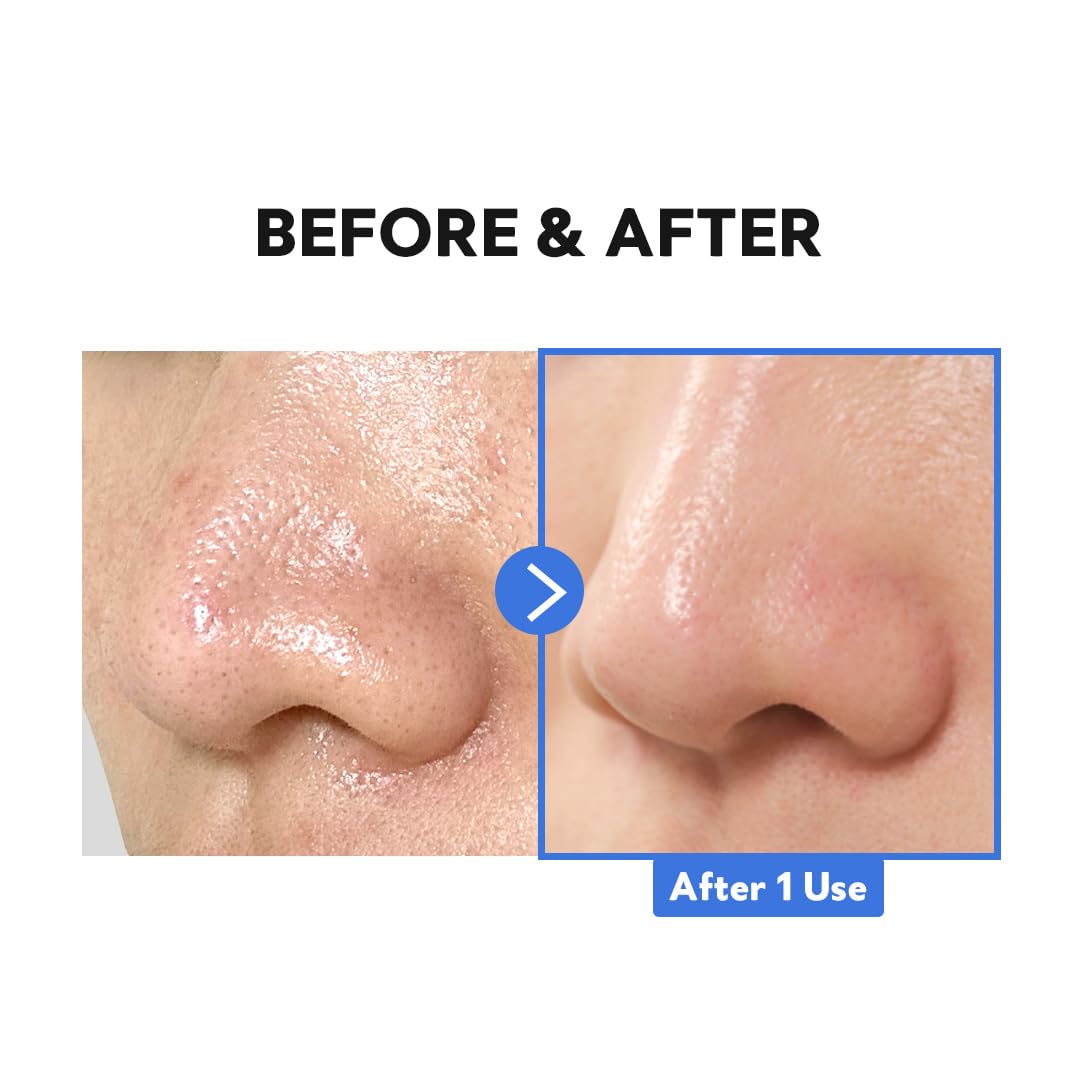 TIRTIR Hydro Boost Enzyme Cleansing Balm (4.05 Ounce (Pack of 1))