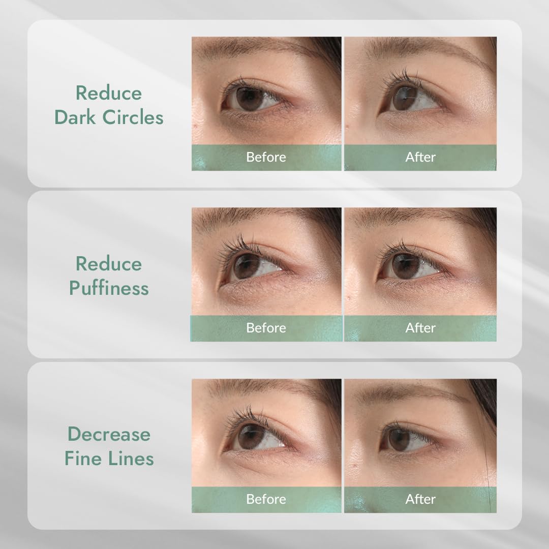 MIZON Cicaluronic Vegan De-puffing Eye Gel Patch, 24K Gold & Cica Under Eye Mask, Reduces Puffy Eyes, Dark Circles and Wrinkles (21 pairs)