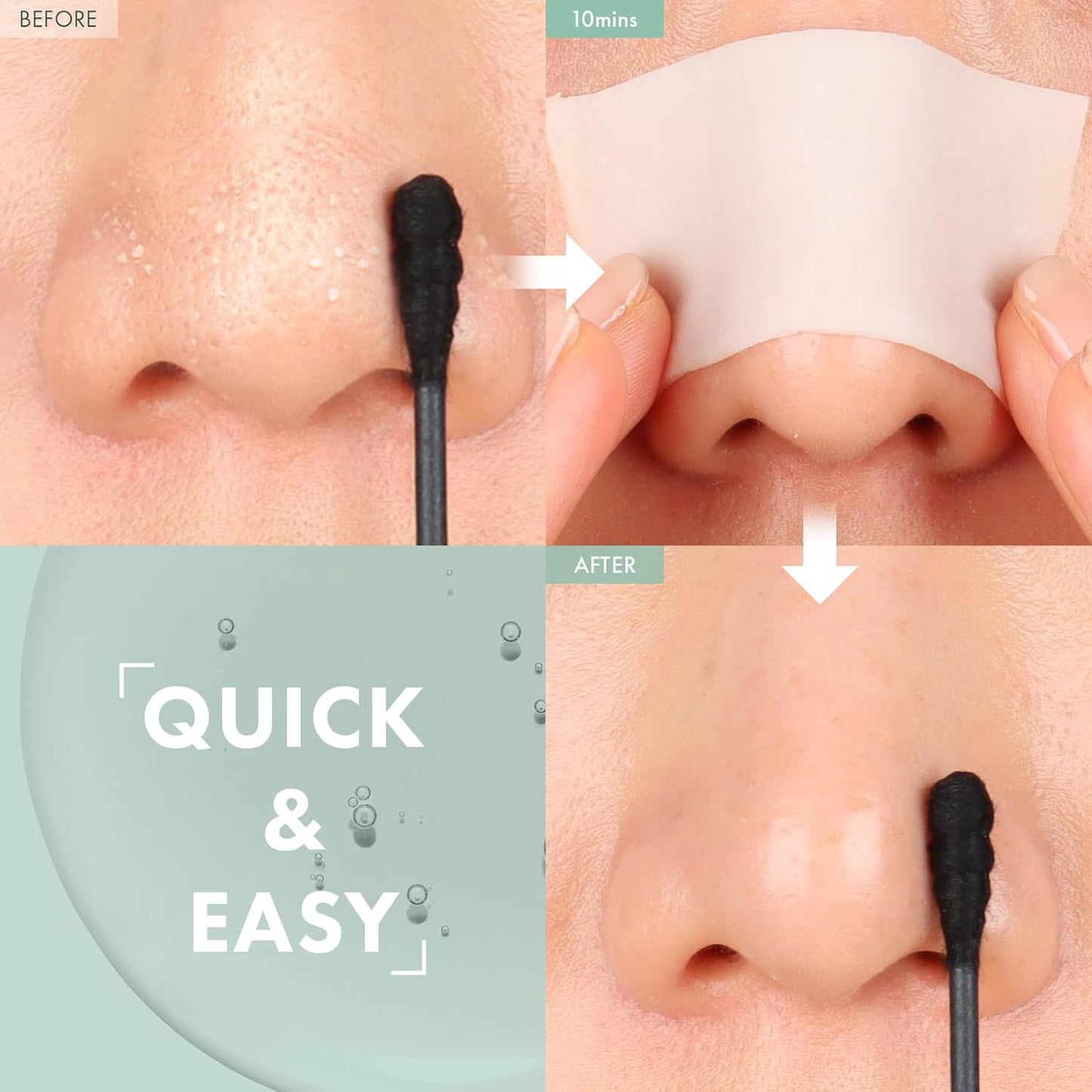 Blackhead Melting Clear with Witch Hazel is ideal for K-beauty routines, effectively removing blackheads , Sebum Control and unclogging pores, 55ml, 1.85 fl. oz.