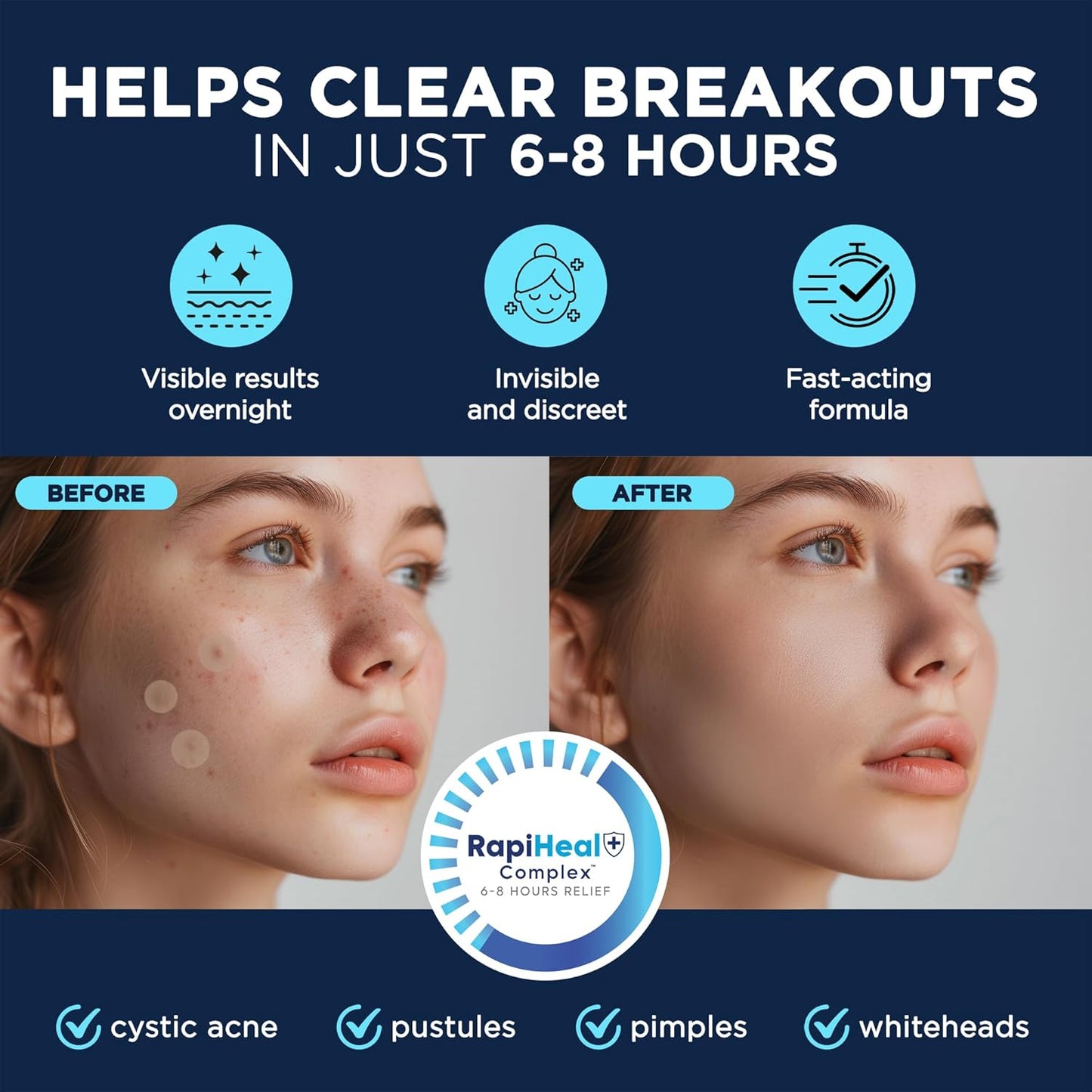 Pimple Patches for Face - 134 Count Hydrocolloid Acne Patches - Zit, Blemish, Cystic Acne Dots & Dark Spot Treatment - Invisible Clear Pimple Patch Stickers for Forehead, Chin, Nose, 3 Sizes (S, M, L)