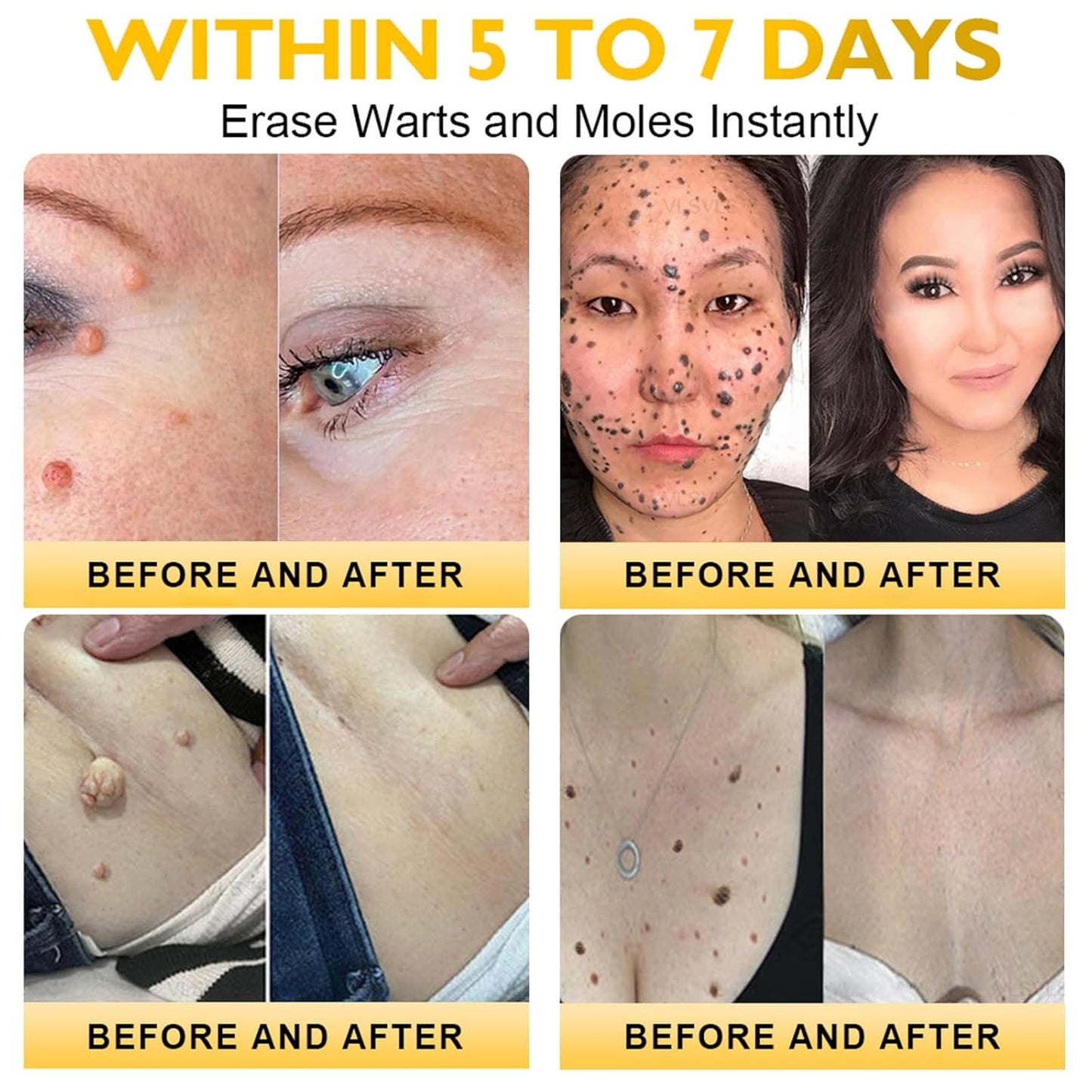 Bee Venom Skin Restoration Cream, Bee Venom Skin Treatment Cream, Professional Bee Venom Comprehensive cream - Anti-Wrinkle Moisturizing for All skin Typess (3)