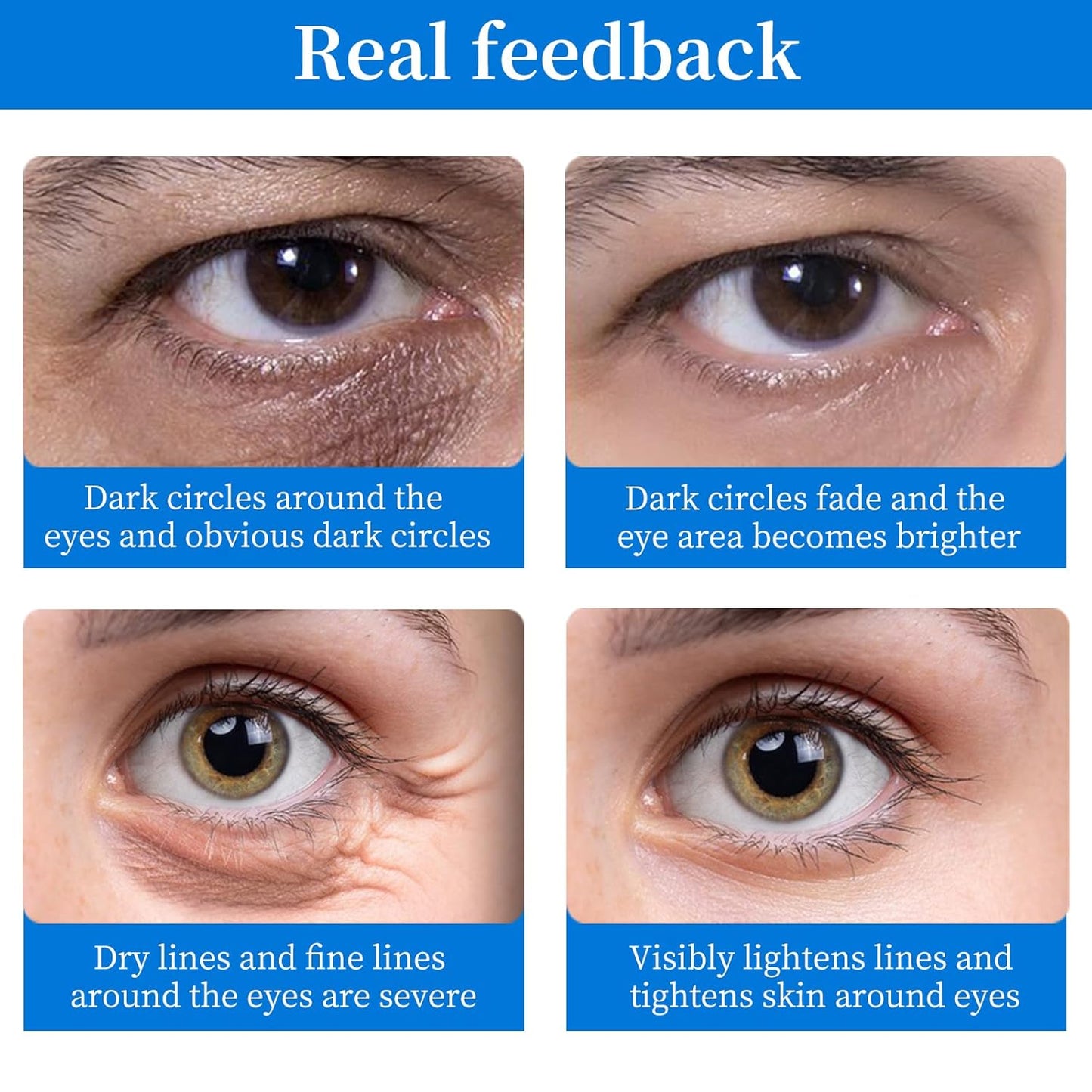 Under Eye patches (64 pcs)-Brightening Eye Mask with Hyaluronic Acid, Cooling Eye Care for Puffy Eyes & Dark Circles Treatments,Reduce Under Eye Bags and Smooth Wrinkles