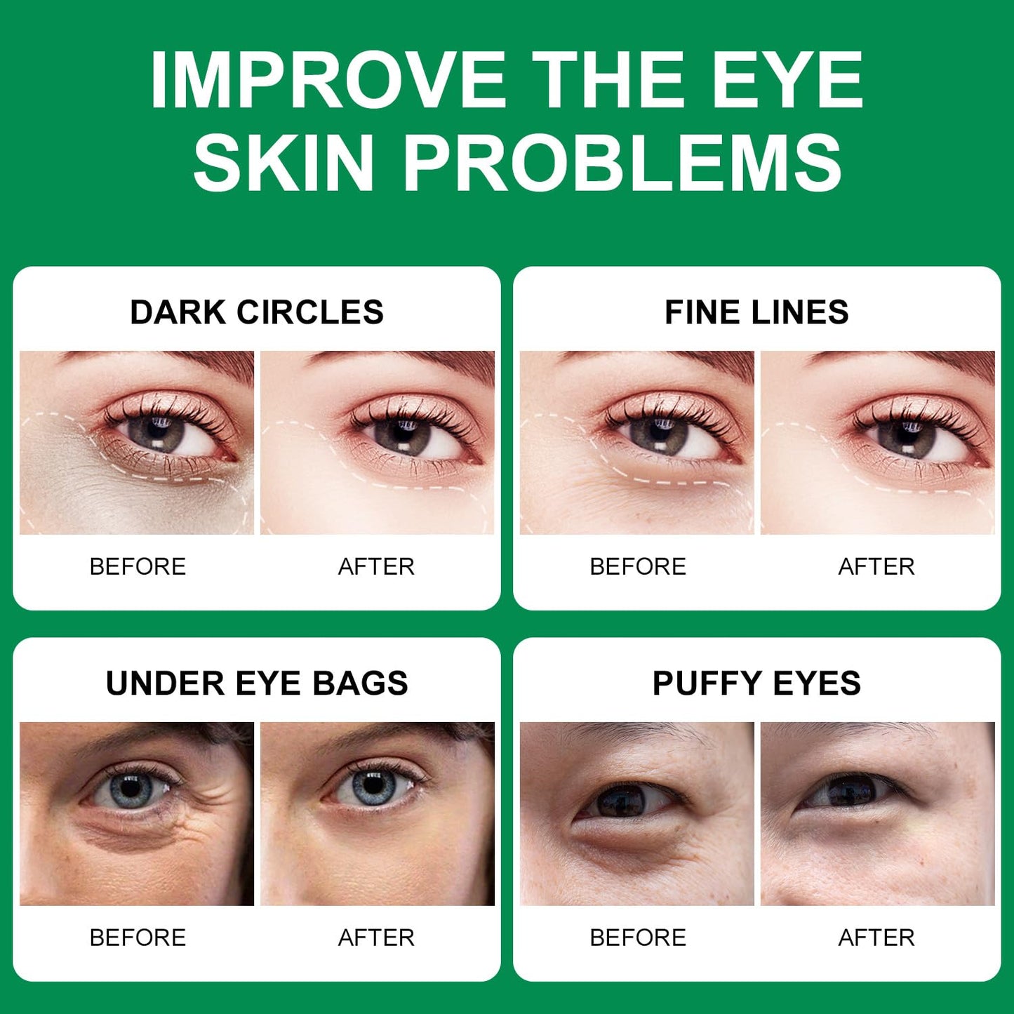 ROUSE Green Algae Under Eye Patches Collagen Eye Mask with Seaweed for Under Eye Bags Dark Circles Natural Eye Gel Pads for Puffy Eyes Moisturizing Repairing-60pcs