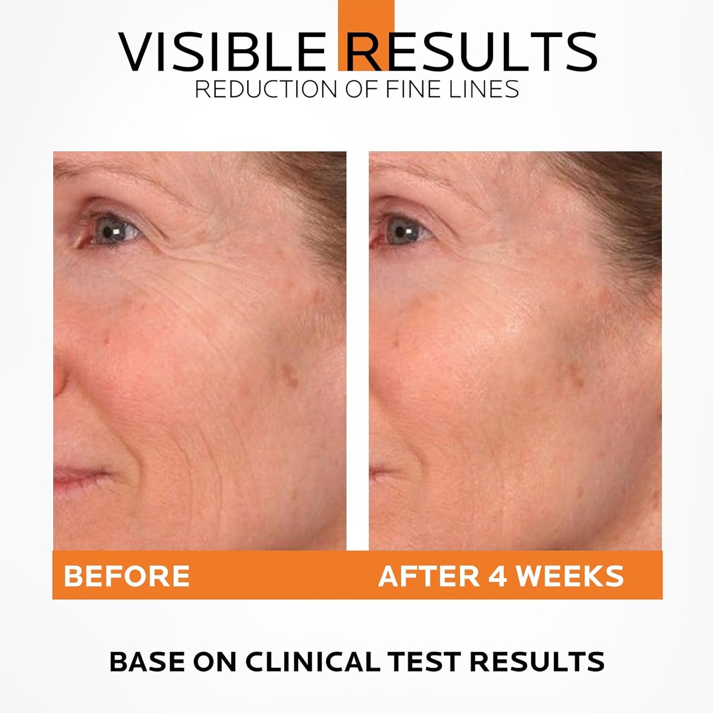 Dr. Pure Retinol 1% in Squalane: Hydrating Even Skin Texture and Tone - Anti-Aging Soothing Fine Lines Night Serum 2 Fl Oz