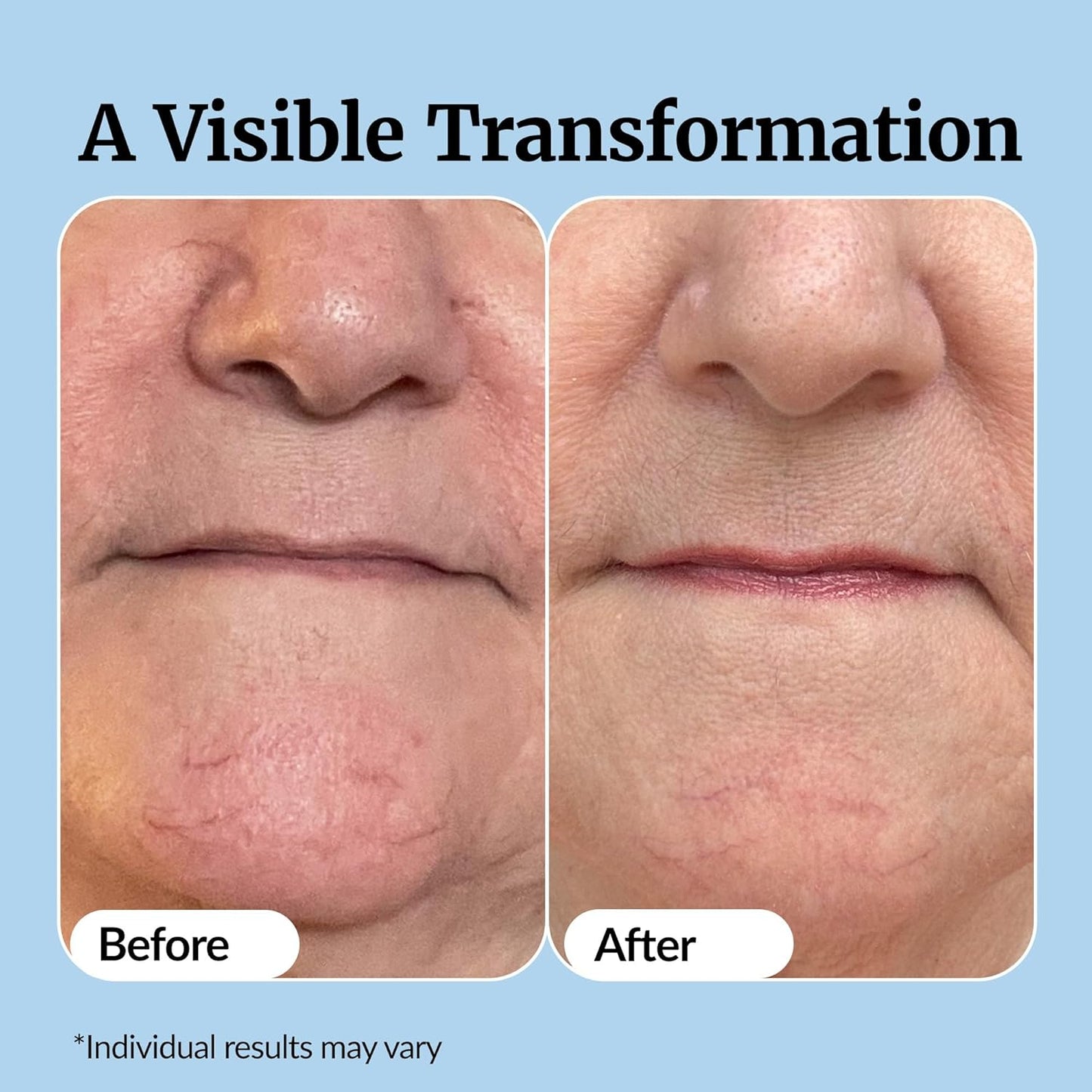 Vibriance Super C Serum for Mature Skin - All-in-One Vitamin Formula Hydrates, Firms, Lifts, Smooths, Targets Age Spots, Wrinkles, 1 fl oz - Pack of 3