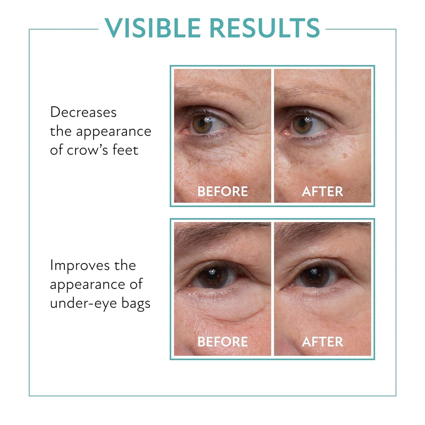 Westmore Beauty 60 Second Effects Tinted Firming Gel - Under Eye Cream For Puffiness And Bags Under Eyes - 10 mL Light to Medium - 0.33 Fl Oz