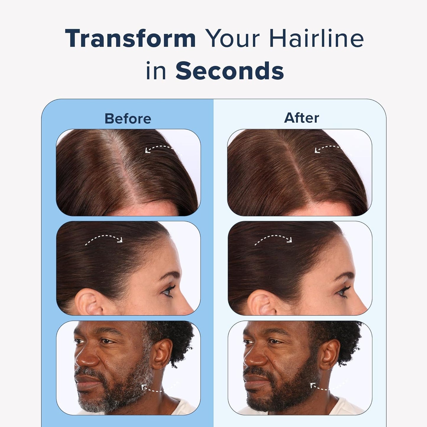 TRUHAIR Jumbo Color & Conceal Waterproof Root Touch Up - Hair Cover Up for Gray Coverage & Hairline Filling - 11 Colors Available (Medium Brown)