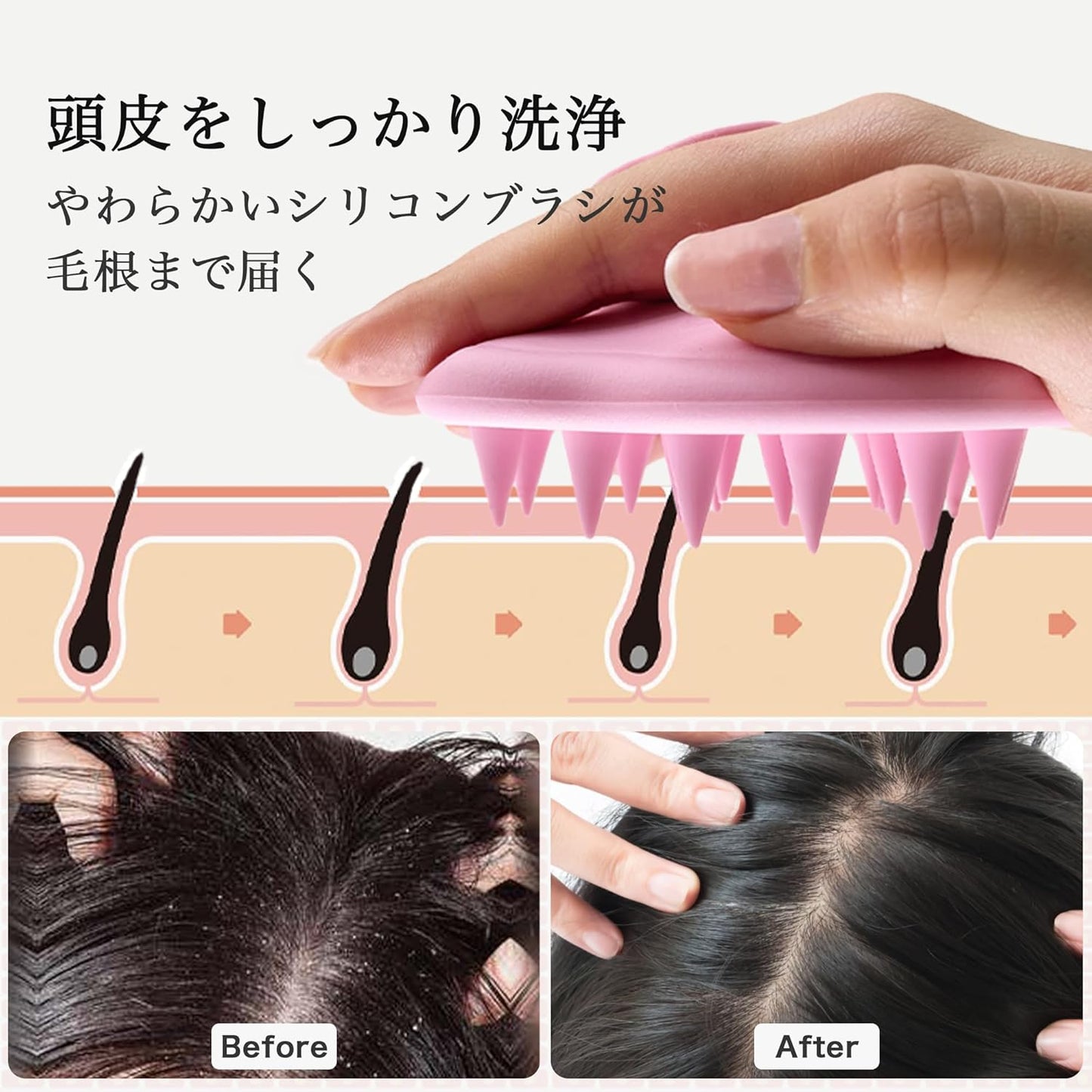 Halocalm Scalp Massager for Hair Growth – Silicone Shampoo Brush for Wet & Dry Hair, Integrated Design, Effective Scalp Scrubber for Shower & Relaxation (Blue)