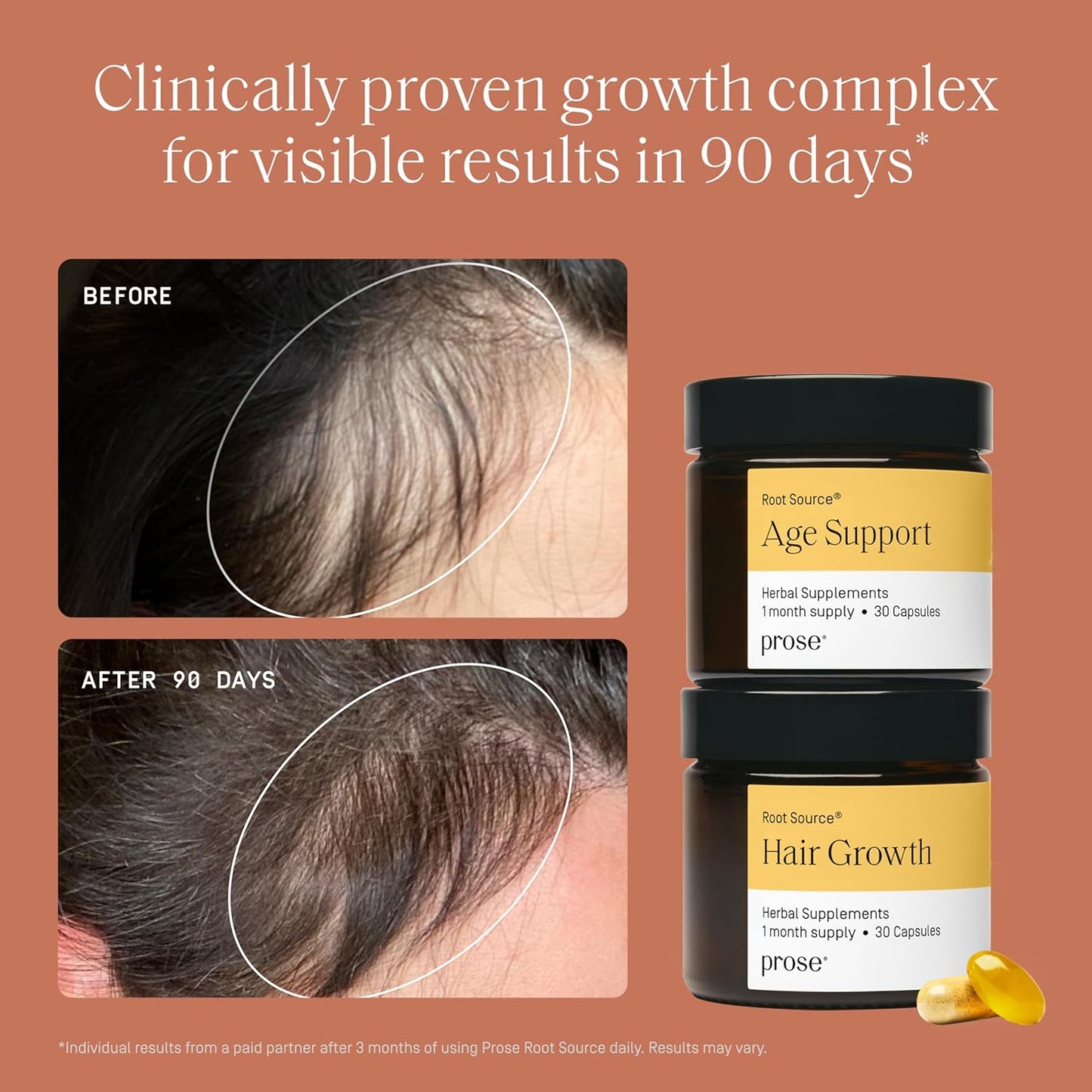 Prose Women’s Age 45+ Hair Growth & Age Support Supplements, Clinically Proven Growth Complex for Visibly Fuller Hair in 90 Days, Vegan, Biotin, No Hormone Disruptors, Gluten Free, 1 Month Supply