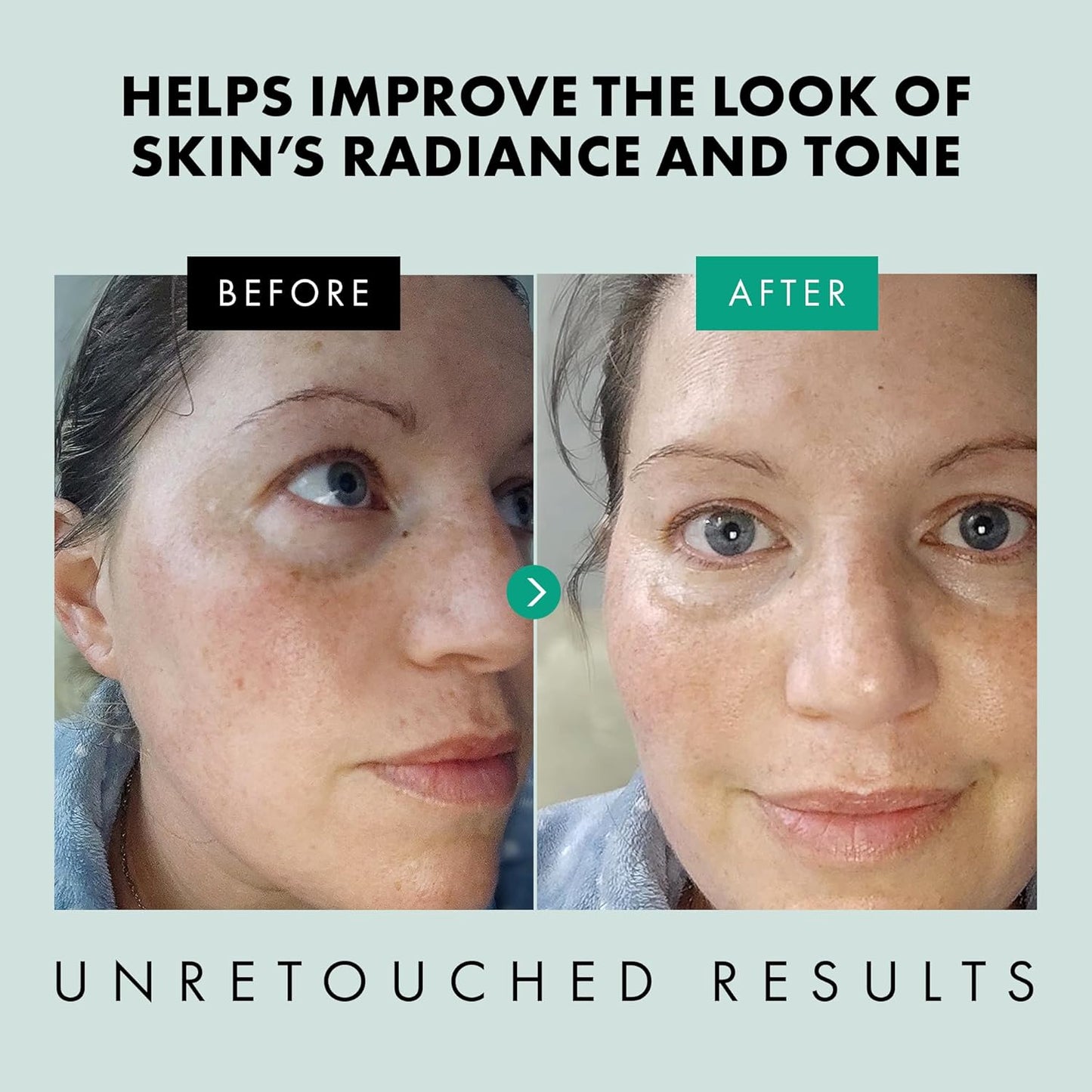 Eclat Skincare Niacinamide Serum - Pore Minimizer for Uneven Complexion - Brightening Niacinamide Serum for Face - Lightening & Moisturizing Skin Care for Dark Spots 1 fl oz