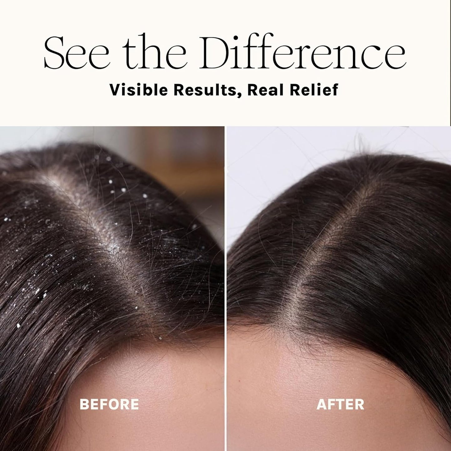 Purist Natural Shampoo – For Dry, Itchy, Flaky & Dandruff Prone Scalps – Natural Aloe Vera & Vitamin-Infused Formula – Vegan, Sulfate-Free, Color-Safe & Paraben-Free - Gentle Detoxifying Cleanser