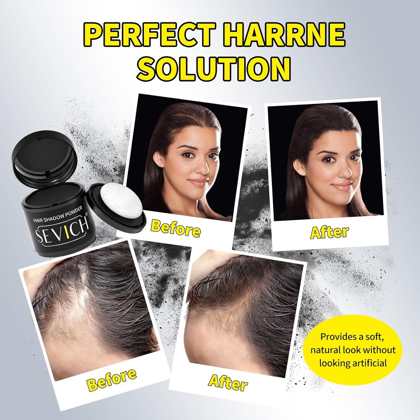Sevich Hairline Powder 10g Large Capacity,Instantly Conceals Hair Loss,Root Touch up Powder,Hair Shadow Toppers for Women & Men Thinning Gray Hair,48H Makeup Lasting,1 Box = 2.5 Boxes,Brown