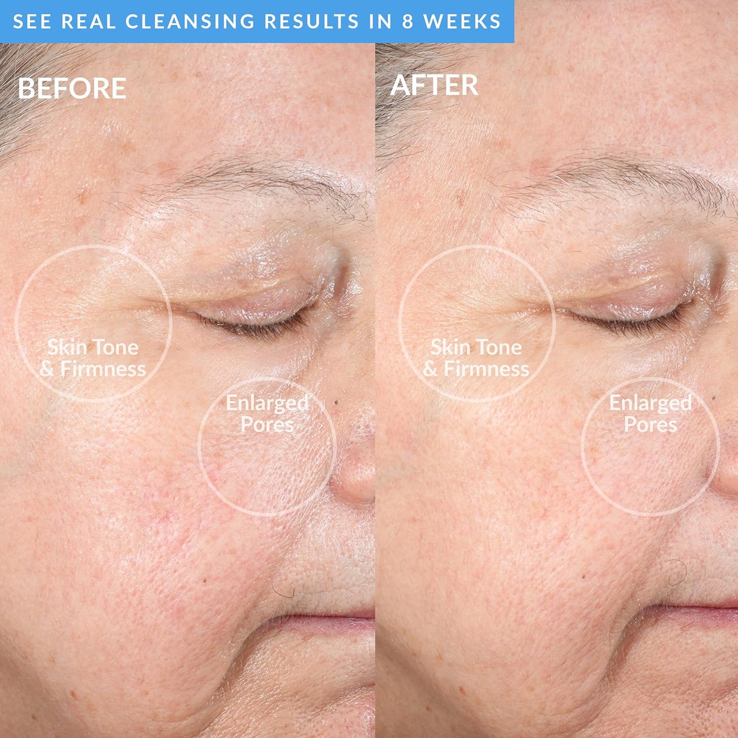 PMD Beauty Facial Cleansing Brush - Smart Silicone Brush with Blue Light Treatment - SonicGlow Vibration - Waterproof Device for Acne