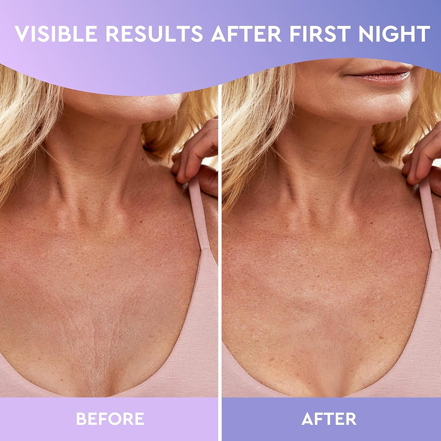 CLEVERFY Silicone Chest Wrinkle Pads Sleeping Reusable (4 Pack T-shape) - Decollete Anti Wrinkle Chest Pads - Silicone Patches for Wrinkles - Anti Wrinkle Patches for Decollete Wrinkle Prevention