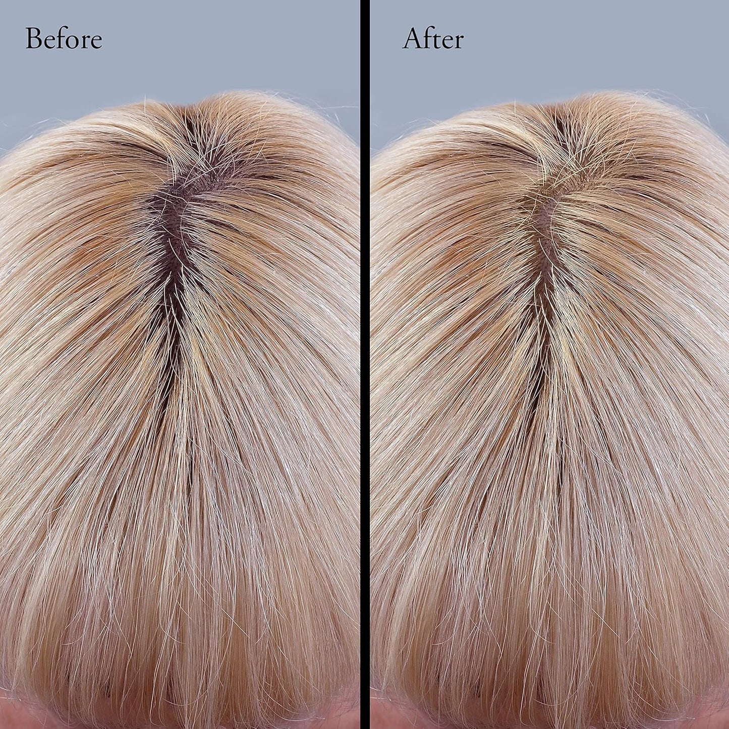 Root Touch Up and Concealer Powder - 11 True-to-Nature Shades - Zero Fragrance, Talc or Parabens - Hairline Powder With Brush by NuBeauti (Blonde)